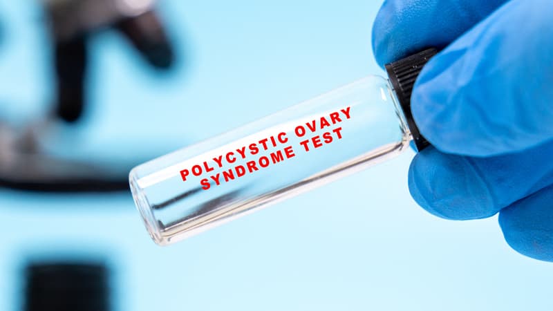 0a192c17-4141-4b8b-abec-f84b83907990 Le syndrome des ovaires polykystiques renommé : un changement nécessaire