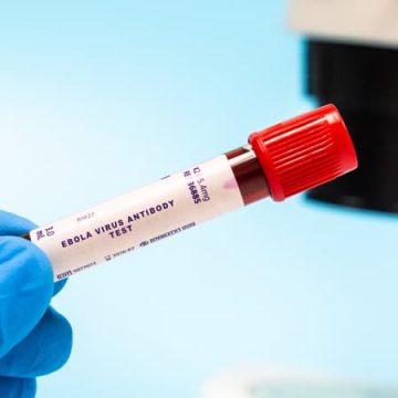544279dd-25f9-4399-b53f-087855c3c0e4 Nouvelle épidémie d’Ebola en République démocratique du Congo