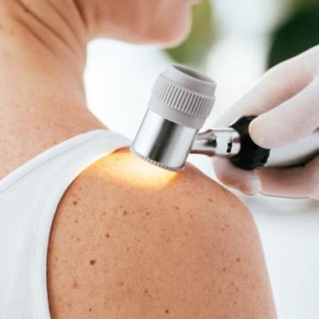 a1d2130c-e97f-40b7-b41f-dbb6961c20a5 Une nouvelle méthode pour détecter précocement les cancers de la peau avec un tatouage intelligent