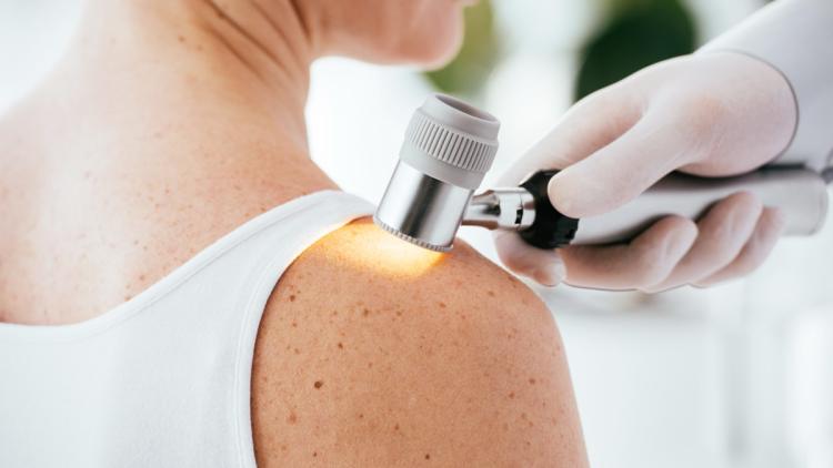 a1d2130c-e97f-40b7-b41f-dbb6961c20a5 Une nouvelle méthode pour détecter précocement les cancers de la peau avec un tatouage intelligent