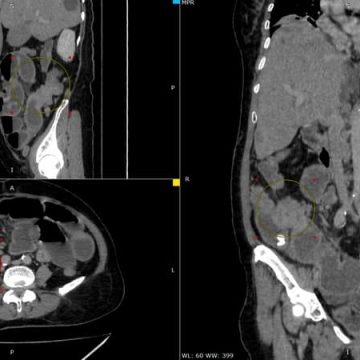 ae5803ba-4537-4a7d-94ef-f3bdcab45820 La dangerosité des vermifuges utilisés contre le cancer