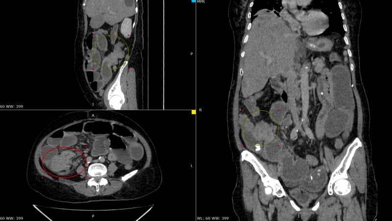 ae5803ba-4537-4a7d-94ef-f3bdcab45820 La dangerosité des vermifuges utilisés contre le cancer