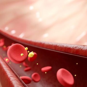 Comprendre le taux de cholestérol et ses implications sur la santé