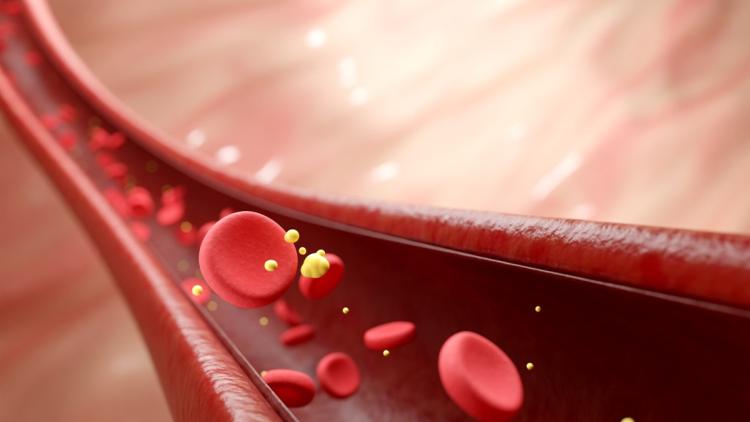 171bea88-39cc-4729-bbbf-43f24caa09ff Comprendre le taux de cholestérol et ses implications sur la santé