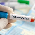 La testostérone : effet sur la santé féminine