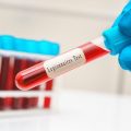 Recrudescence de légionellose en Savoie: deux décès et 41 cas recensés