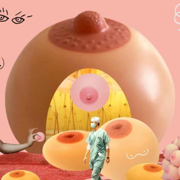 Chirurgie du sein : Entre reconstruction et perception de soi