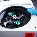 Progrès dans la lutte contre le mélanome : Moderna et Merck annoncent des avancées significatives