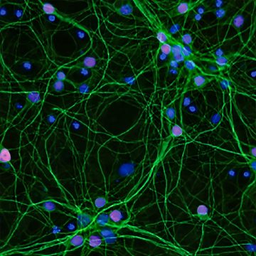 Microscopic image of neurons L’outil CRISPR et ses effets sur la maladie de Charcot