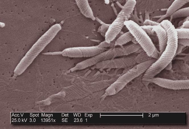 72bdc07d-1dc4-4949-b6aa-07a7bd546c8c Les infections à l’origine de nombreux cancers en 2024 : état des lieux et prévention