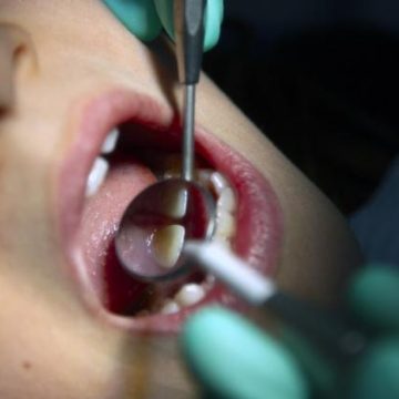 8516a1f5-860b-4f18-861f-83dfee51baf1 La réduction des remboursements de soins dentaires
