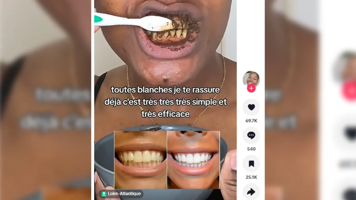 a8e76017-1e6e-4ed1-a6d3-d331b6eeb790 Les risques des recettes maison pour le blanchiment des dents