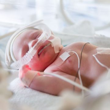 premature newborn baby in incubator Les enfants prématurés : un suivi sur dix ans révèle leur état de santé