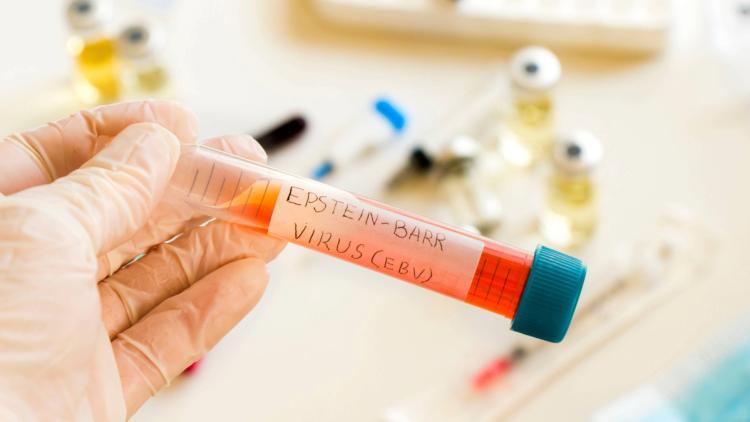 d2d21a1f-dde4-4ec3-94fb-e7ce0e635bc0 Le rôle des infections dans les cas de cancer mondiaux