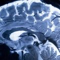 Le cerveau humain: Une nouvelle découverte bouleversante