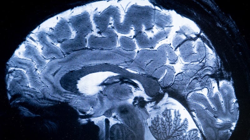 e35f1097-cc48-4123-a7b3-ba3856beeecb Le cerveau humain: Une nouvelle découverte bouleversante