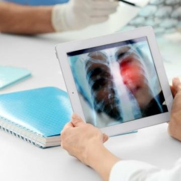 Symptômes révélateurs de poumons en mauvaise santé