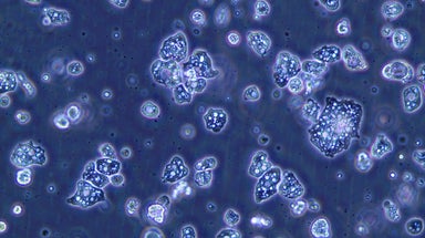 2e969d0b-90dd-454f-950e-8fef4b2bba2f Le parcours et l’avenir prometteur d’Amoéba dans le biocontrôle agricole