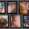 Enquête sur les Violences Policières lors de Manifestations