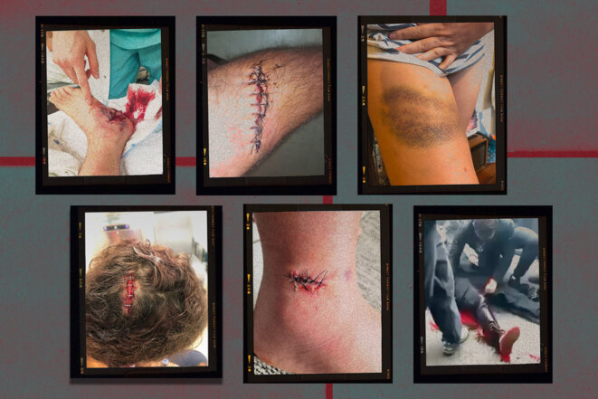 40e491de-560e-4b1d-a3fc-3dca6984b457 Enquête sur les Violences Policières lors des Manifestations du 17 Octobre